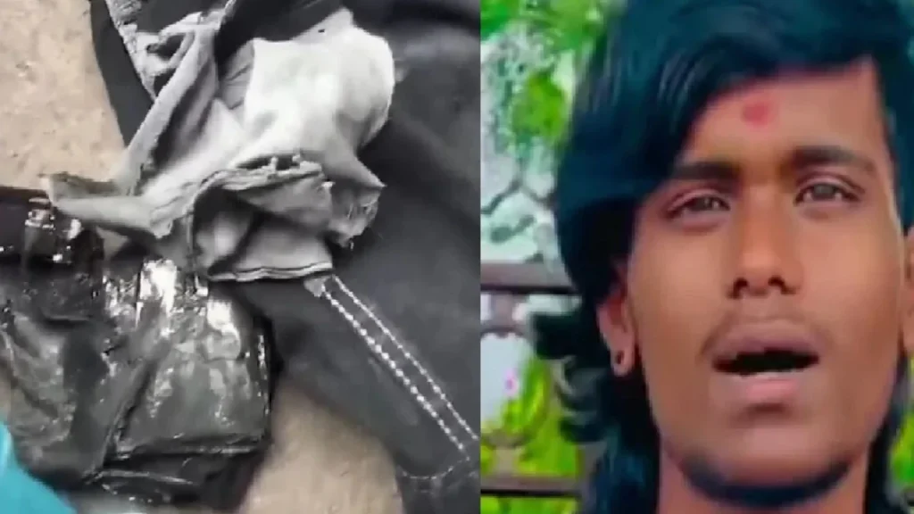 ಜೇಬಿನಲ್ಲಿದ್ದ ಪವರ್ ಬ್ಯಾಂಕ್ ದಿಢೀರ್ ಸ್ಫೋಟ; ಯುವಕನ ಕಾಲಿಗೆ ಗಂಭೀರ ಗಾಯ