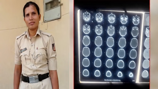 ರೈಲ್ವೆ ಠಾಣೆಯಲ್ಲಿ ಗರ್ಭಿಣಿ ಕಾನ್ಸ್ಟೇಬಲ್ ಮೇಲೆ ರಾಡ್ನಿಂದ ಮಾರಣಾಂತಿಕ ಹಲ್ಲೆ